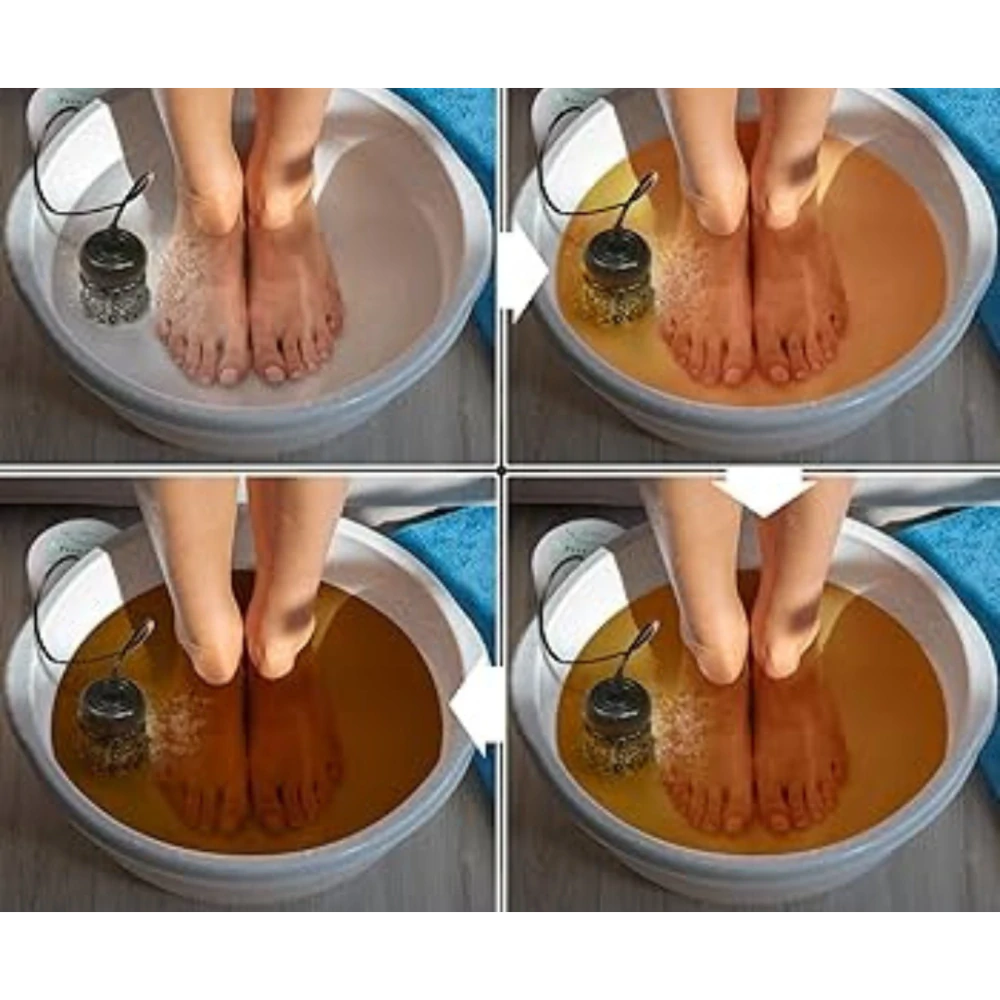 Iontová detoxikace